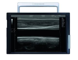 SmartEcho 128
