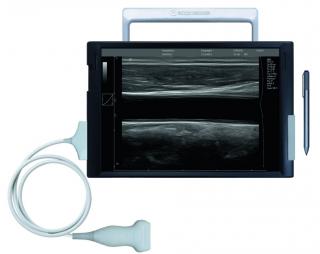 SmartEcho 128